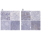 Immunohistochemical staining of human duodenum, kidney, pancreas and tonsil using Anti-IRF4 antibody HPA002698 (A) shows similar protein distribution across tissues to independent antibody HPA002038 (B).
