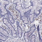 Immunohistochemical staining of human duodenum shows moderate nuclear positivity in lymphoid cells.