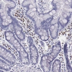 Immunohistochemical staining of human duodenum shows moderate nuclear positivity in lymphoid cells.