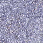 Anti-IRF4 Antibody