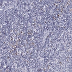Immunohistochemical staining of human tonsil shows moderate nuclear positivity in non-germinal center cells.