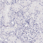 Anti-IRF4 Antibody