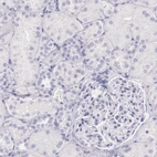 Immunohistochemical staining of human kidney shows no positivity in cells in tubules as expected.