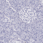 Immunohistochemical staining of human pancreas shows no positivity in exocrine glandular cells as expected.