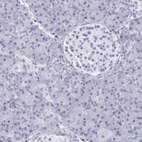 Anti-IRF4 Antibody