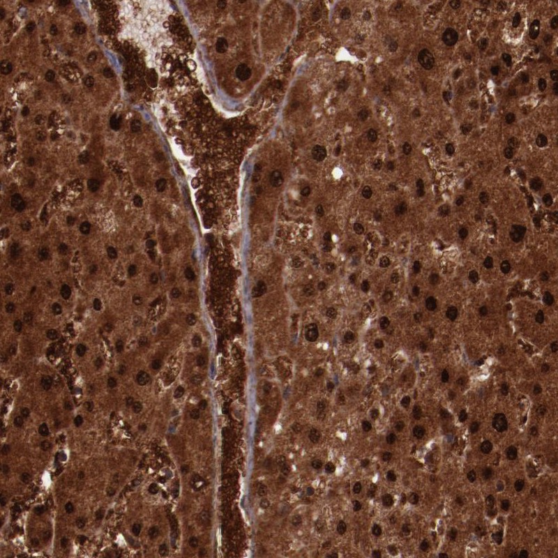 Anti-FTSJ1 Antibody