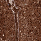 Anti-FTSJ1 Antibody