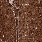Anti-FTSJ1 Antibody