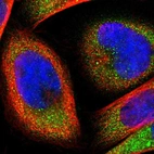 Immunofluorescent staining of human cell line A-431 shows localization to cytosol.