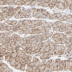 Immunohistochemical staining of human heart muscle shows strong membranous positivity in cardiomyocytes.