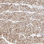 Immunohistochemical staining of human heart muscle shows strong membranous positivity in cardiomyocytes.