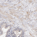Immunohistochemical staining of human prostate shows weak membranous positivity in smooth muscle cells.