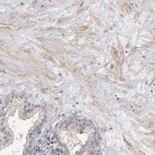 Immunohistochemical staining of human prostate shows weak membranous positivity in smooth muscle cells.