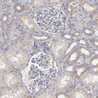 Immunohistochemical staining of human kidney shows no positivity in cells in glomeruli.