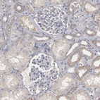 Immunohistochemical staining of human kidney shows no positivity in cells in glomeruli.
