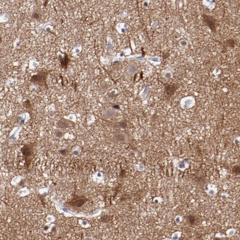Anti-NRXN3 Antibody
