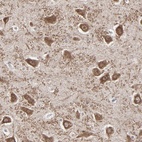 Anti-SLC22A17 Antibody