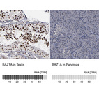 Anti-BAZ1A Antibody