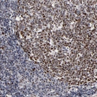Immunohistochemical staining of human tonsil shows strong nuclear positivity in germinal center cells.