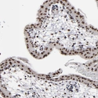 Immunohistochemical staining of human placenta shows strong nuclear positivity in syncytiotrophoblast.