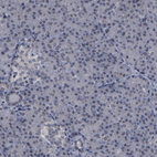 Anti-BAZ1A Antibody