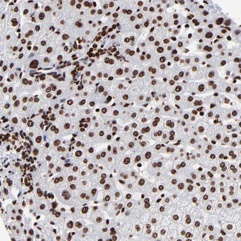 Anti-ZNF544 Antibody