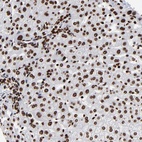 Anti-ZNF544 Antibody