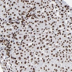 Anti-ZNF544 Antibody