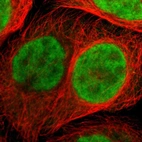 Immunofluorescent staining of human cell line A-431 shows localization to nucleoplasm.