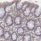 Immunohistochemical staining of human rectum shows moderate cytoplasmic positivity in glandular cells.