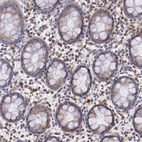 Immunohistochemical staining of human rectum shows moderate cytoplasmic positivity in lymphoid cells.