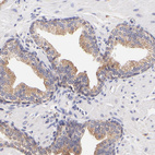 Anti-RPL11 Antibody