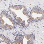 Immunohistochemical staining of human prostate shows moderate cytoplasmic positivity in glandular cells.
