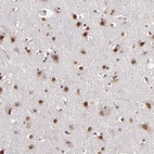 Immunohistochemical staining of human cerebral cortex shows strong nuclear positivity in neurons.