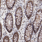 Immunohistochemical staining of human colon shows strong nuclear positivity in glandular cells.