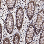 Immunohistochemical staining of human colon shows strong nuclear positivity in glandular cells.