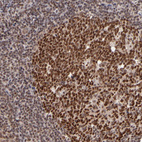 Anti-TERF2 Antibody