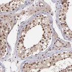 Immunohistochemical staining of human testis shows moderate nuclear positivity in cells in seminiferous ducts.