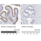 Anti-CFAP57 Antibody