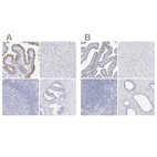 Immunohistochemical staining of human fallopian tube, liver, lymph node and prostate using Anti-CFAP57 antibody HPA002736 (A) shows similar protein distribution across tissues to independent antibody HPA028623 (B).