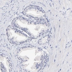 Immunohistochemical staining of human prostate shows no positivity in glandular cells as expected.