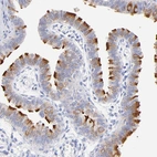 Immunohistochemical staining of human Fallopian tube shows strong positivity in cilia in glandular cells.