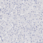 Immunohistochemical staining of human liver shows no positivity in hepatocytes as expected.