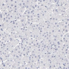 Immunohistochemical staining of human liver shows no positivity in hepatocytes as expected.