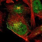 Immunofluorescent staining of human cell line U-251 MG shows localization to nucleoplasm, plasma membrane & the Golgi apparatus.