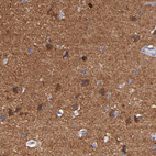 Anti-CNTNAP2 Antibody