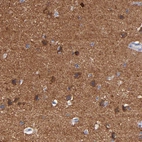 Immunohistochemical staining of human cerebral cortex shows strong cytoplasmic positivity in neuropil.