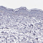 Immunohistochemical staining of human skin shows no positivity in squamous epithelial cells as expected.