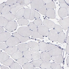 Immunohistochemical staining of human skeletal muscle shows no positivity in myocytes as expected.