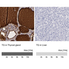 Anti-TG Antibody